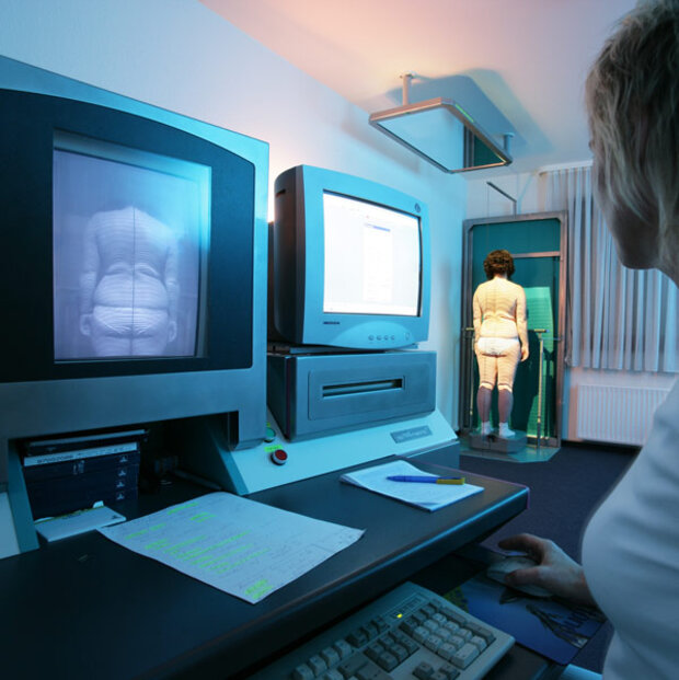 3D Vermessung der Wirbelsäule